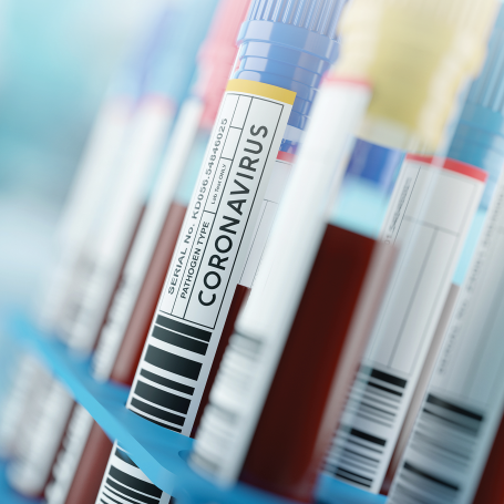 FRONTEO Commences Drug Repositioning Research on Novel Coronavirus (COVID-19) Using Best-In-Class AIのサムネイル